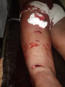 Warga Desa Petir Jadi Korban Penusukan Tetangganya Sendiri