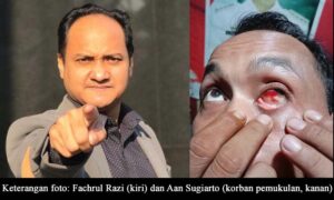 Ketua Komite I DPD RI Desak Polisi Usut Tuntas Pelaku Penganiayaan terhadap Jurnalis di Pringsewu