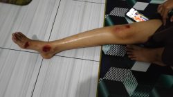 Mahasiswi Terjatuh di Lubang Jalan, Warga Desak DPUPR Banten Perbaiki Jalan Rusak di Serang-Pandeglang